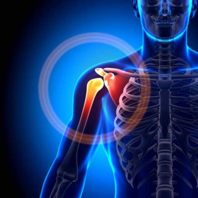 shoulder and collar pain animation